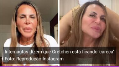 ‘Gretchen rebate ataques a novo visual: ‘Se estou ficando careca, é problema meu’