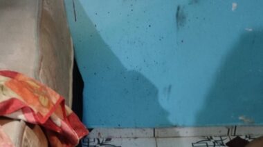 ESPIA… homem é acordado com tiros na cabeça no bairro Compensa; veja imagem