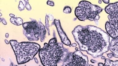 Langya: China alerta para a identificação de um novo vírus em humanos