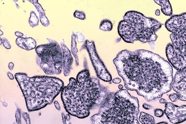 No momento, você está visualizando Langya: China alerta para a identificação de um novo vírus em humanos