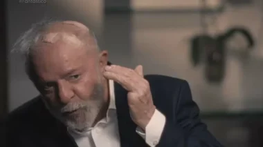 Lula diz que está com furos na cabeça e dá detalhes de acidente
