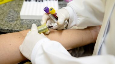 Prefeitura capacita profissionais de saúde e lança boletim como parte de campanha contra tuberculose