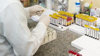 Prefeitura divulga primeira edição de informativo sobre cenário de casos de Mpox em Manaus