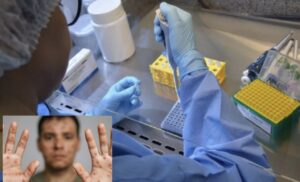 Leia mais sobre o artigo ATENÇÃO AMAZONAS: 33 casos de Mpox são confirmados; autoridades alertam para riscos de transmissão