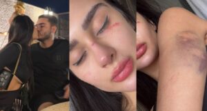 Leia mais sobre o artigo VÍDEO: Miss Grand Amazonas denuncia agressões físicas e ameaças de morte do ex-namorado